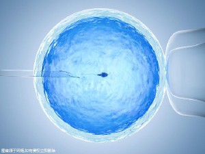 李雪梅